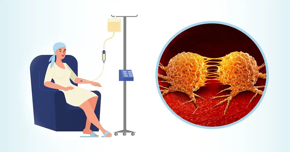 Este tratamiento contra el cáncer podría propagar las células metastásicas