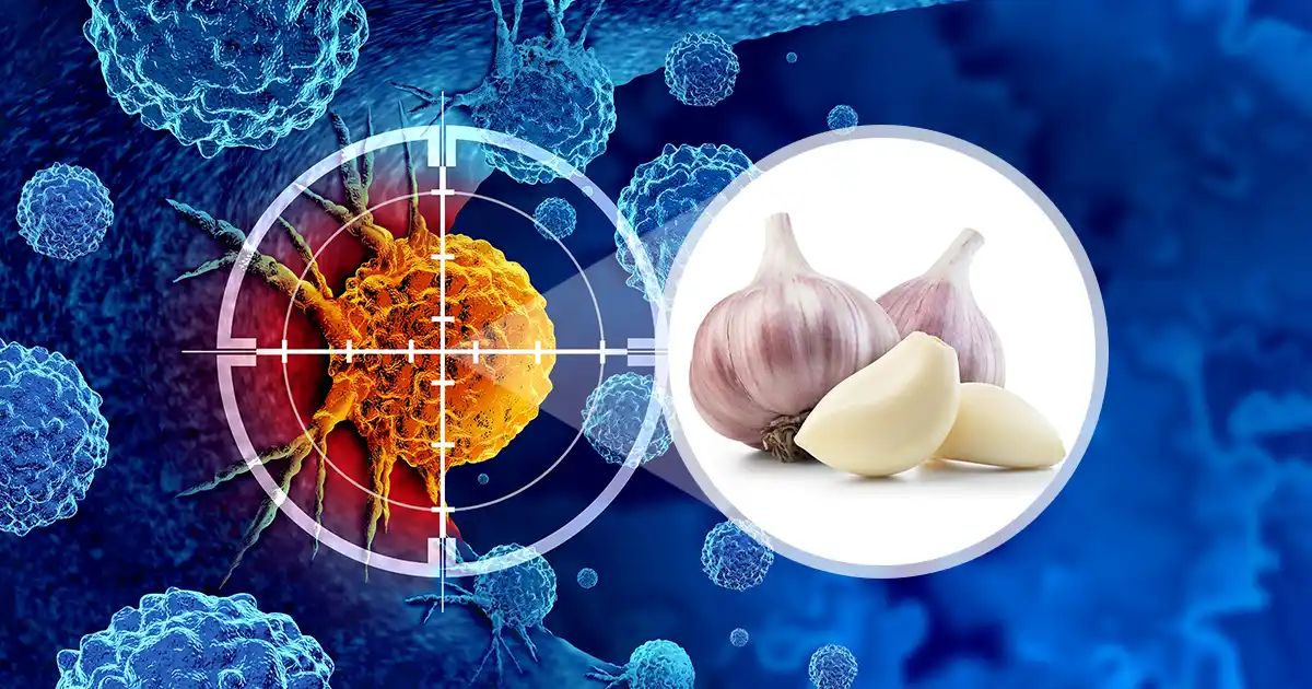 Estudio confirma los beneficios del ajo en el cáncer