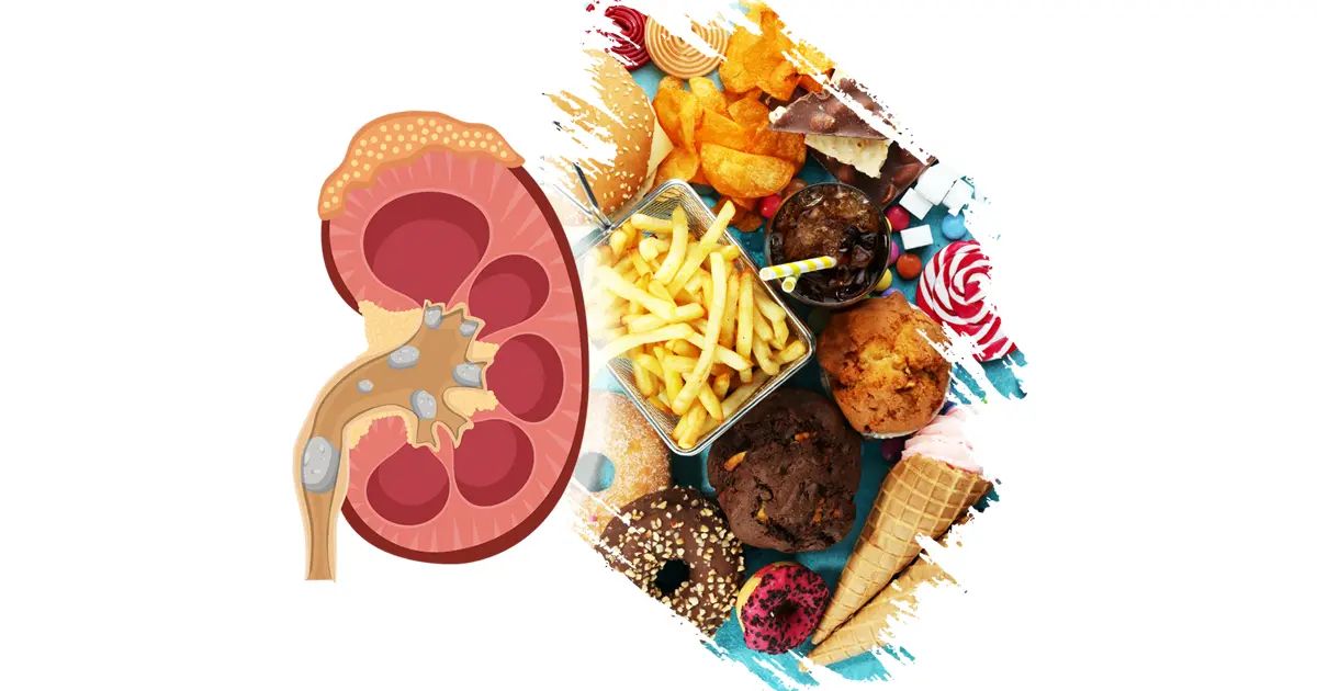 La conexión entre sus hábitos alimenticios y su salud renal