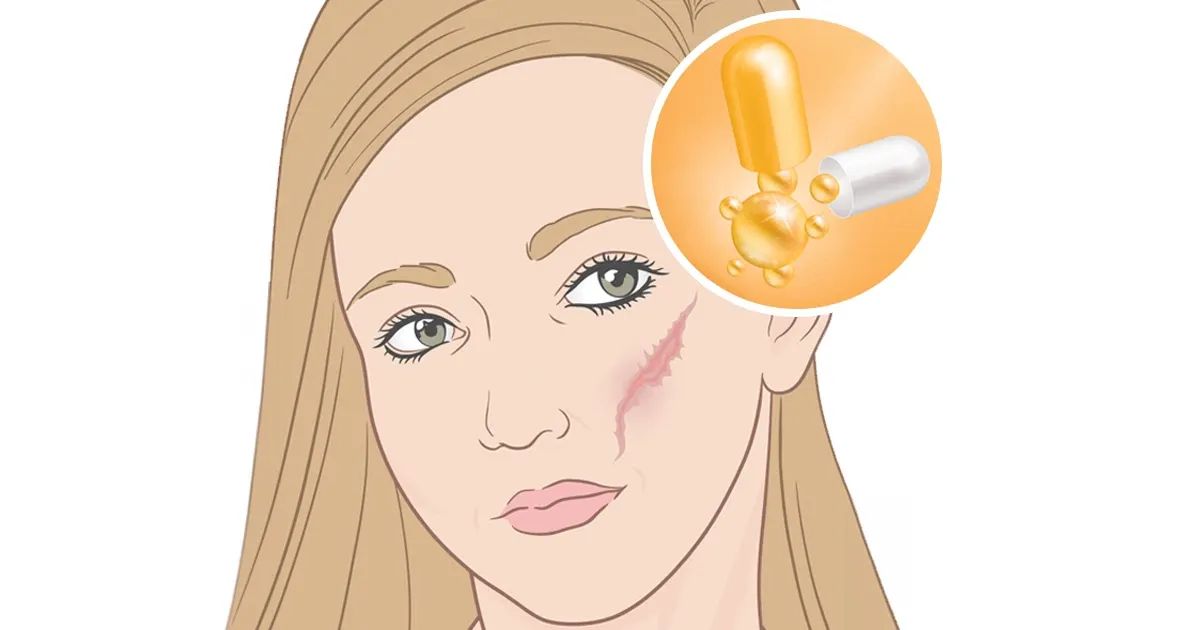 Si sus heridas no sanan bien, esta vitamina puede marcar la diferencia