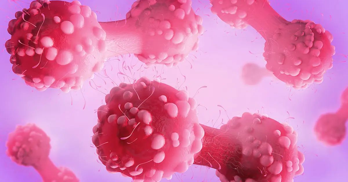 Este problema podría abrirle la puerta al cáncer: actúe a tiempo