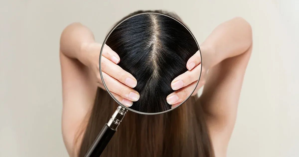 Recupere este equilibrio natural que protege su cuero cabelludo