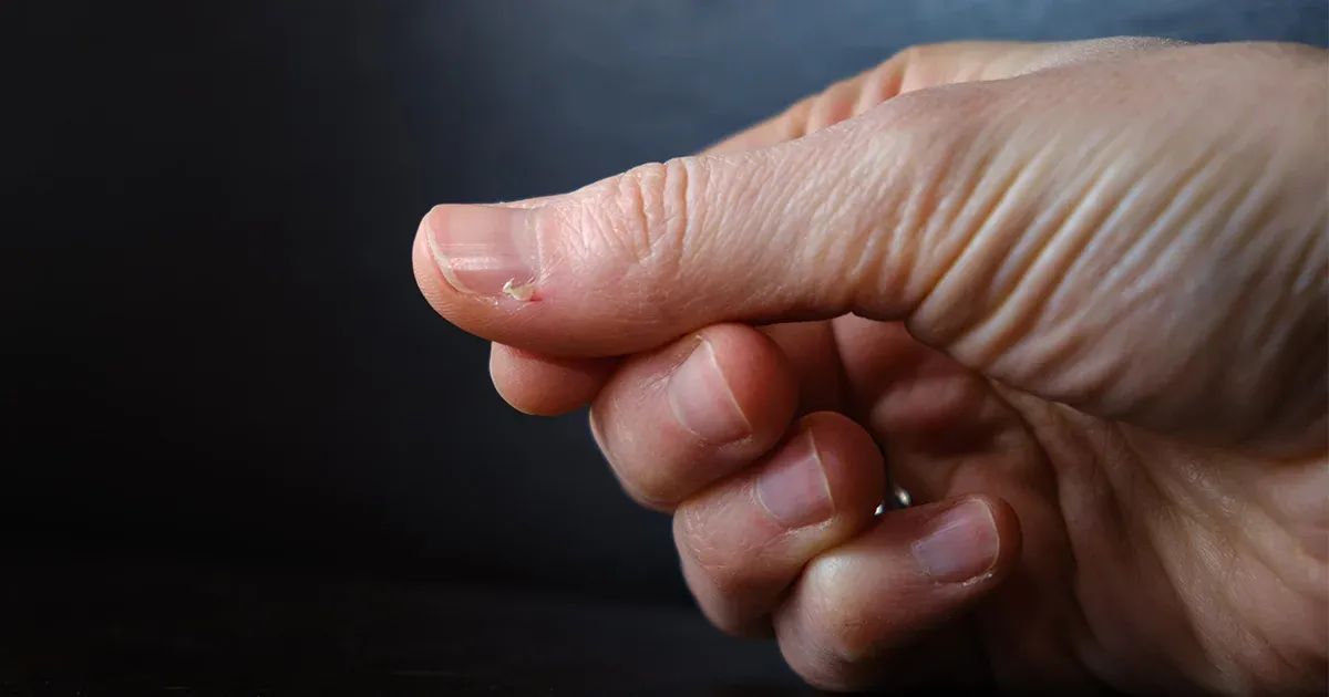 La señal oculta en sus manos que podría afectar su salud