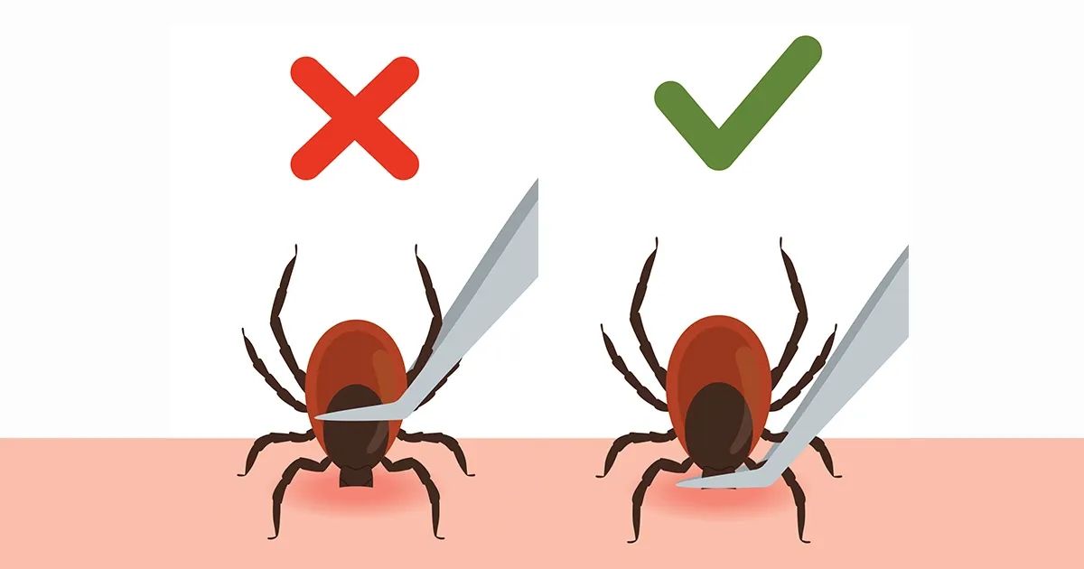 Un mal movimiento al retirar a este invasor podría desencadenar un problema serio de salud