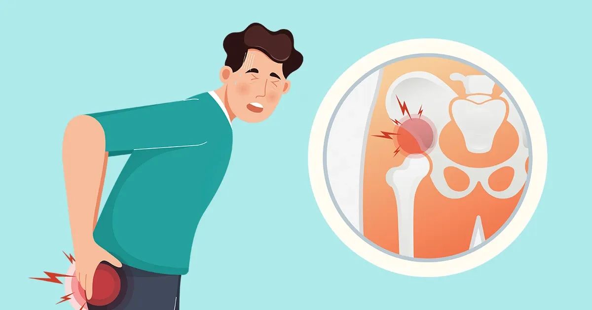 Proyecciones clínicas alertan sobre un fuerte aumento de las fracturas más graves