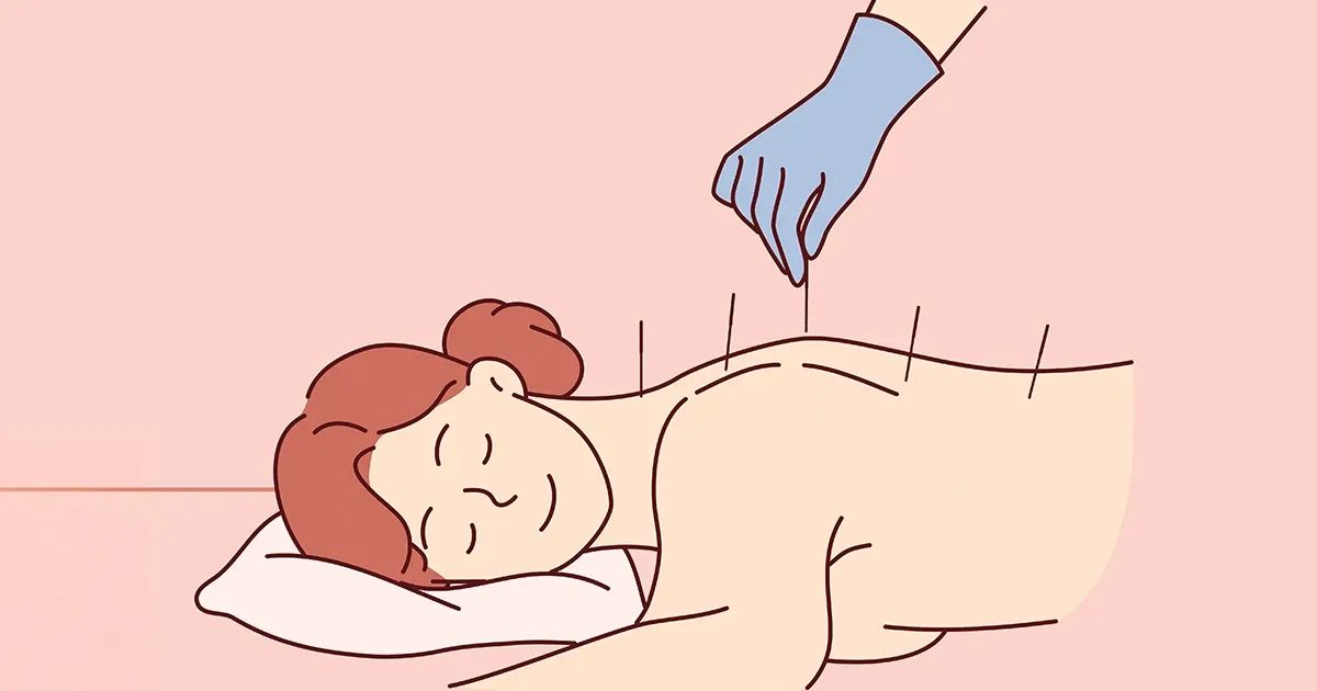 Un enfoque antiguo está sorprendiendo a quienes viven con dolor lumbar persistente