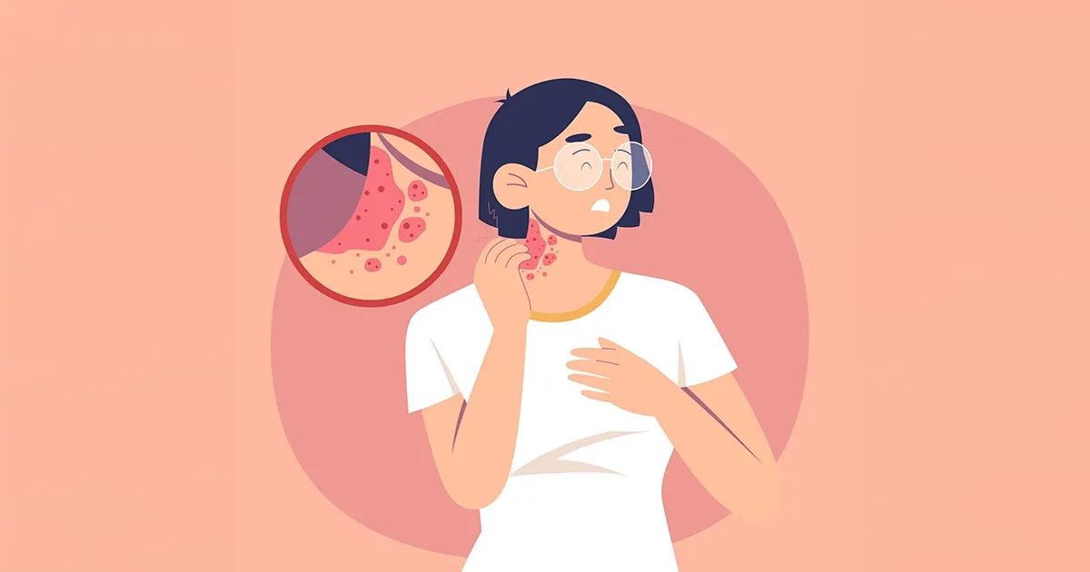 Inflamación crónica en la piel y una fuente de exposición que pocos consideran