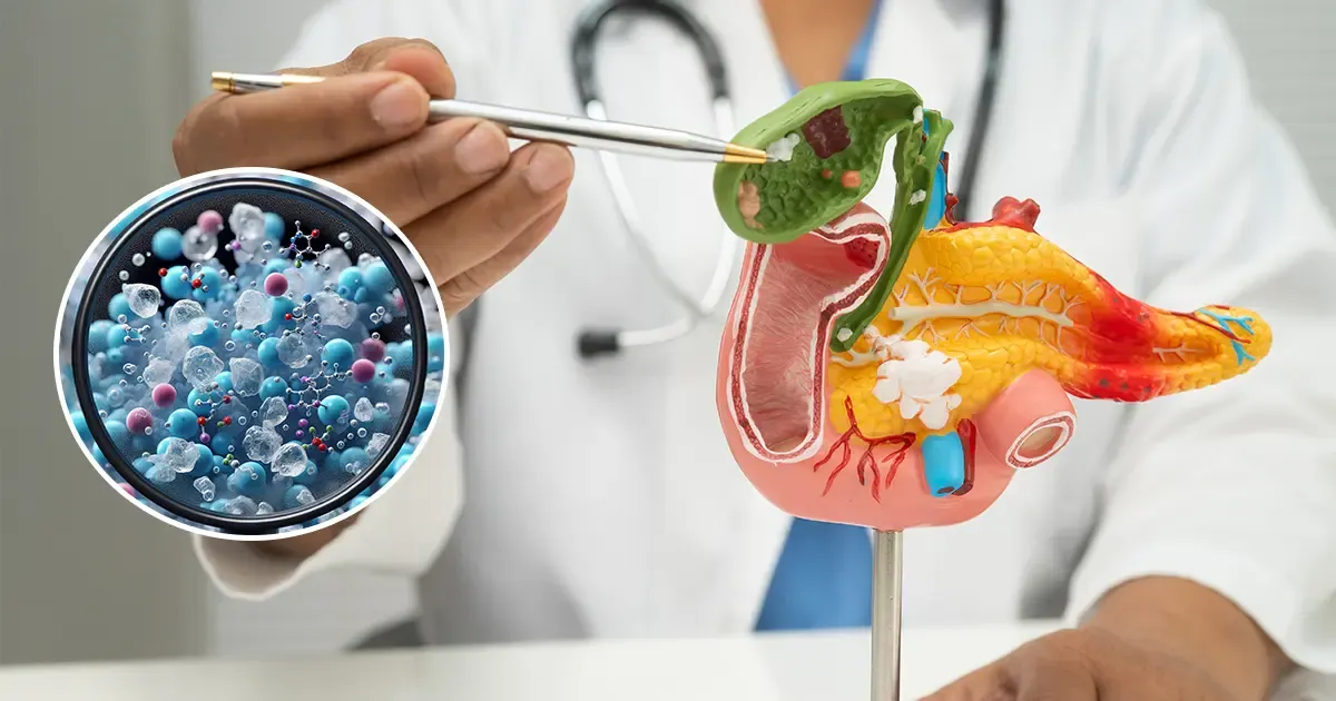 Esta acumulación se relaciona con inflamación y daño celular