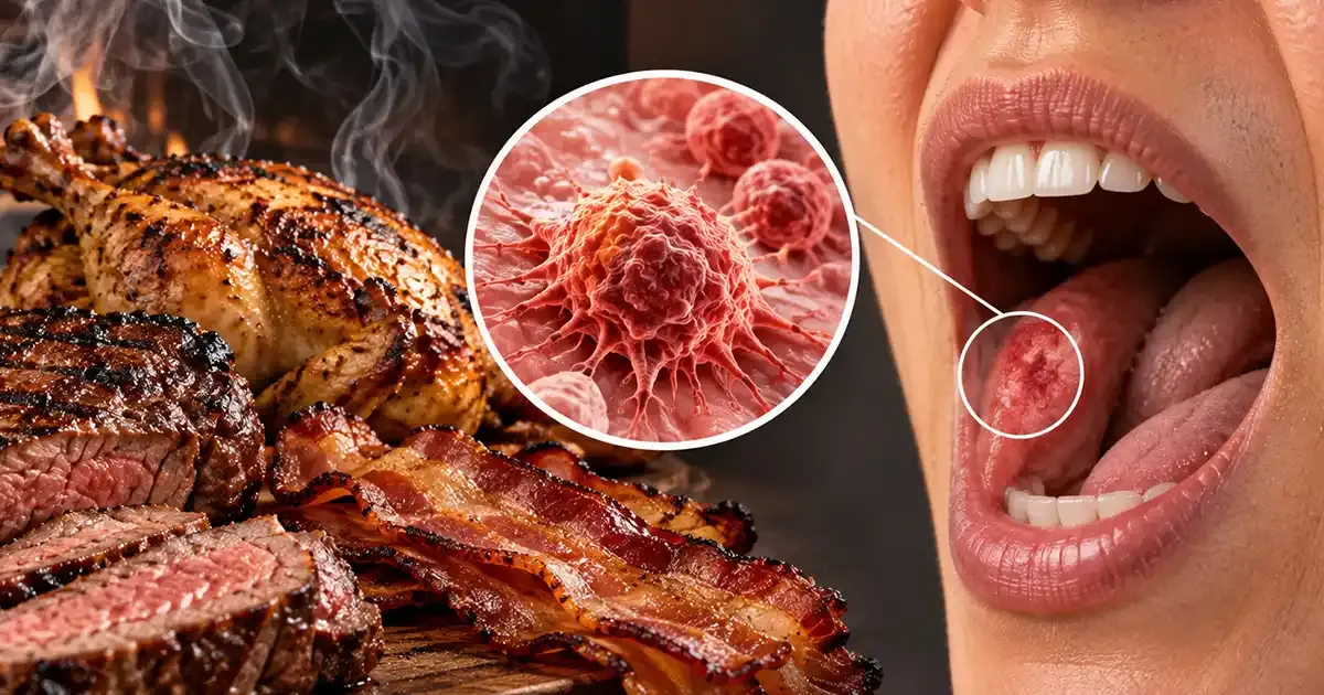 La forma en que prepara estos alimentos podría relacionarse con un mayor riesgo de cáncer oral