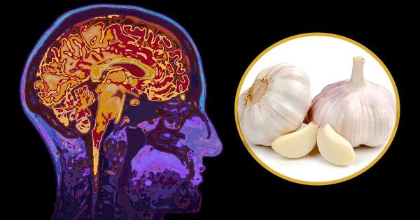 El ajo podría proteger la salud del cerebro