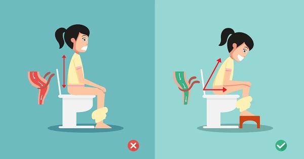 Esta postura para hacer popó podría aliviar su estreñimiento