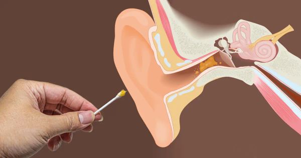 Los riesgos del exceso de cerilla