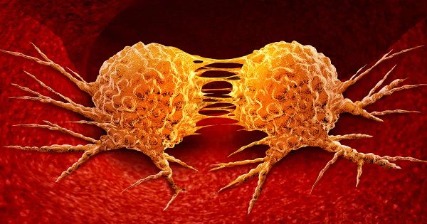 El tratamiento contra el cáncer desde una perspectiva metabólica