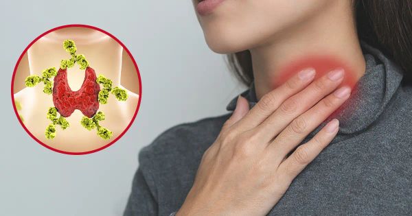 Mercola responde: ¿Qué hacer si tiene la enfermedad de Hashimoto?