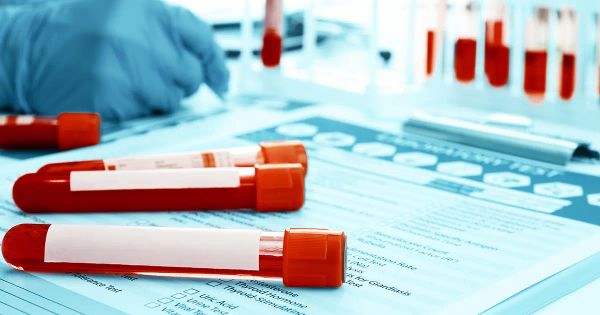 Tres análisis de sangre que revelan su riesgo de enfermedad cardíaca