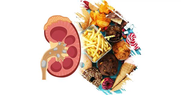 La conexión entre sus hábitos alimenticios y su salud renal