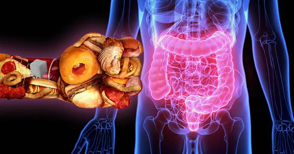 Si quiere proteger su colon, estos son los alimentos que no debe consumir