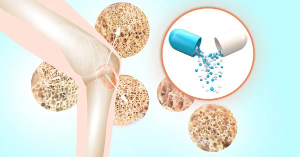 ¿Sus huesos están perdiendo fuerza? Esta vitamina podría ser la solución