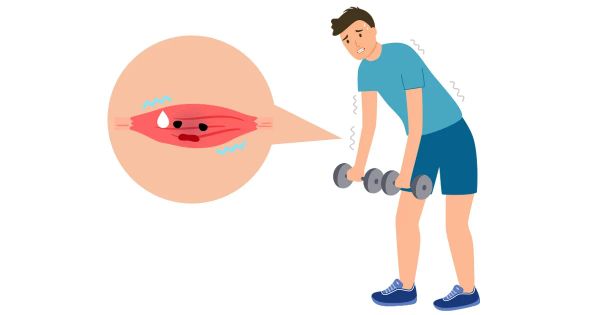 Evite estos alimentos, podrían dañar sus músculos para siempre