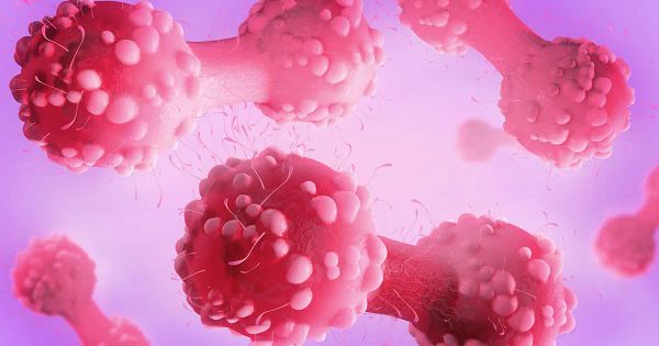 Este problema podría abrirle la puerta al cáncer: actúe a tiempo