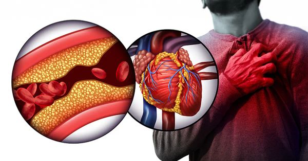 Diga adiós al colesterol alto con este enfoque natural y seguro