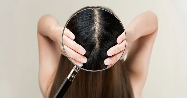 Recupere este equilibrio natural que protege su cuero cabelludo