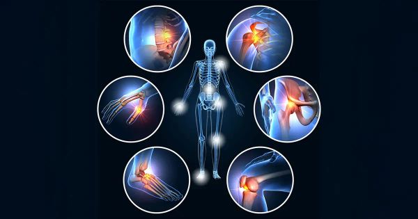 Fracturas, artritis y pérdida de densidad: la nueva realidad de la salud ósea en todas las edades