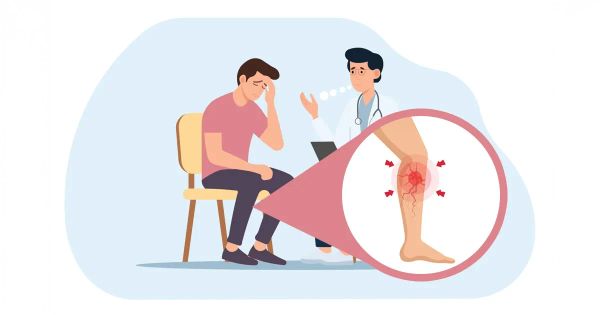 Más allá de lo estético: el problema de las venas que podría ser señal de algo peor