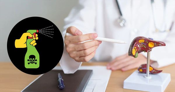 ¡Alerta! Este veneno silencioso invade millones de hígados en el mundo