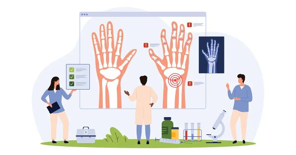 Un sistema inmune envejecido explica la progresión de la artritis crónica