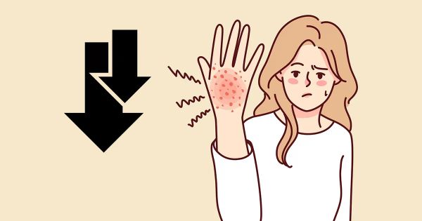 Cuando dos hormonas caen, la inflamación toma el control de su piel