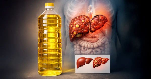 El aceite de cocina favorito de todos podría estar relacionado con la obesidad