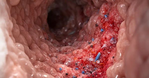 Parece inofensivo, pero este contaminante podría estar inflamando su intestino