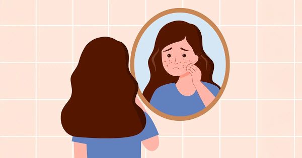 Este cambio en su entorno está  intensificando la inflamación en su piel