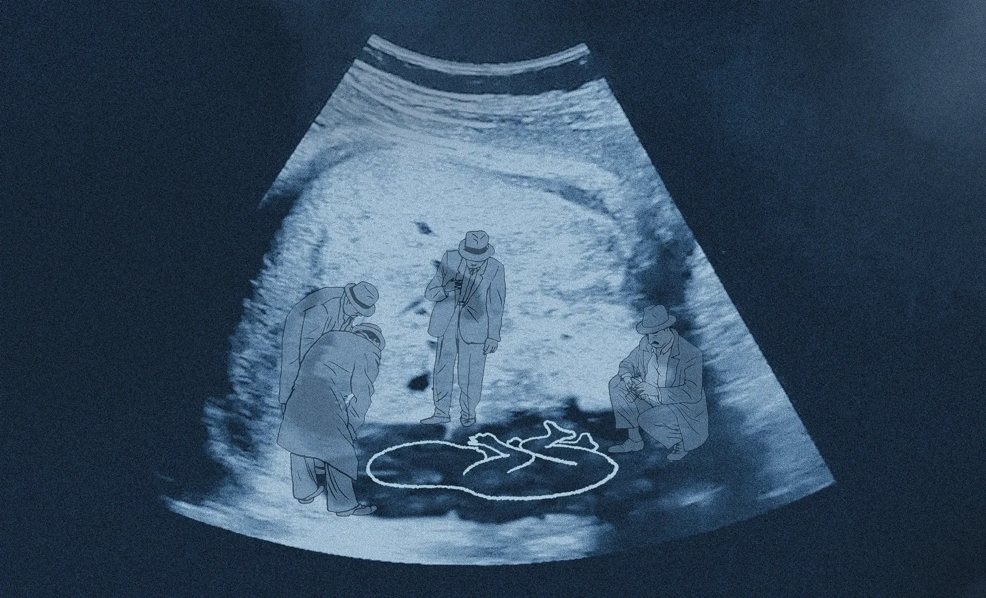 Anti-Abortion: The Case for Life