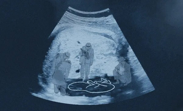 Anti-Abortion: The Case for Life