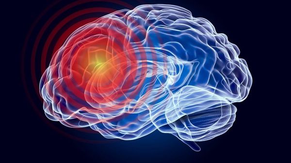 A brain in pain