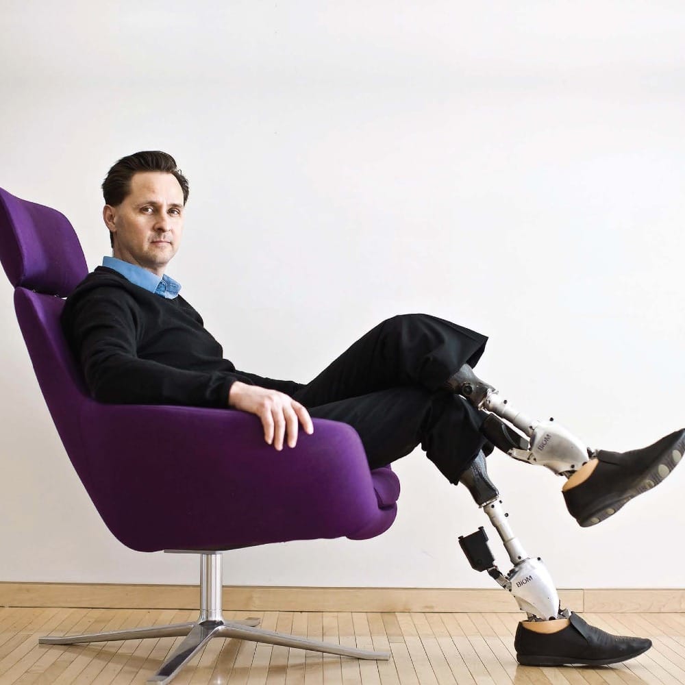 Бионические конечности