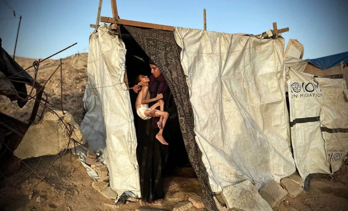 Cómo los propagandistas israelíes distorsionan los hallazgos de la ONU sobre el hambre en Gaza