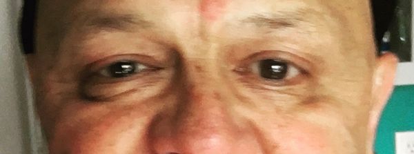miracle monday: doctor, my eyes . . .
