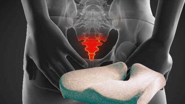 What is the Best Pillow for Tailbone Pain? Coccyx Doctor's Advice