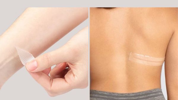 Does Silicone Tape Really Work on Scars? Validating Its Effectiveness