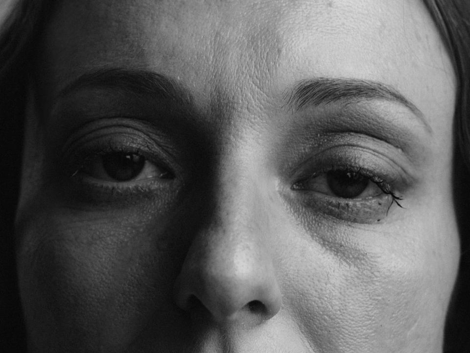 The Role of Chiron, The Wounded Healer, in Your Chart