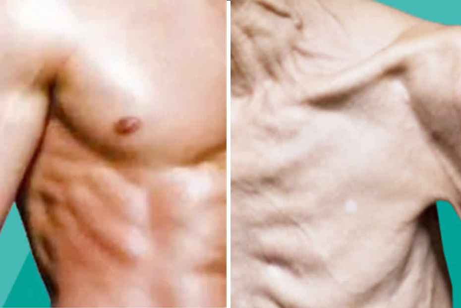 person looking weak and underweight