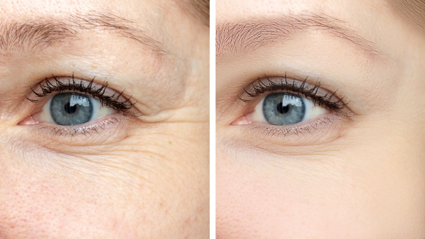 eye fine line