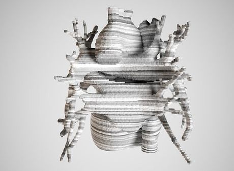Organ transplant? A 3D printer might be able to help