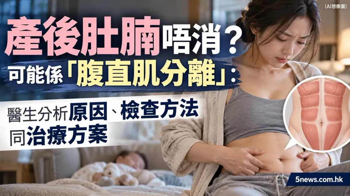 產後肚腩唔消？可能係「腹直肌分離」：醫生分析原因、檢查方法同治療方案