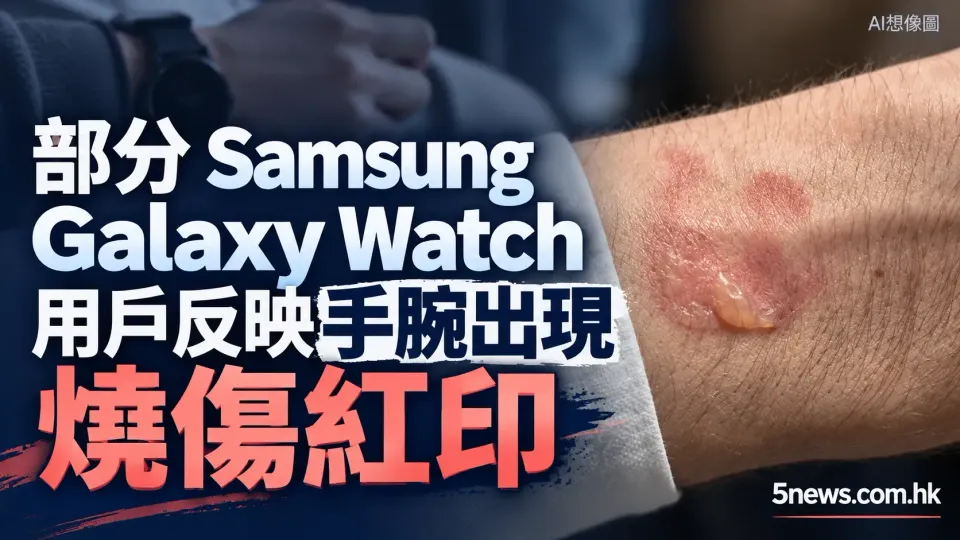 部分 Samsung Galaxy Watch 用戶反映手腕出現燒傷紅印