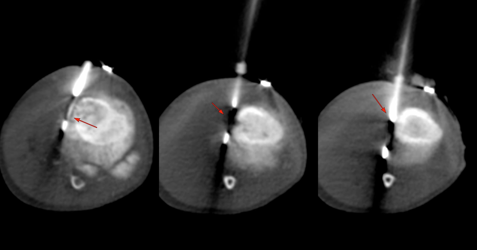 Case of the Day - 094 - 2025 09 01 - Between a Rock and a Hard Place