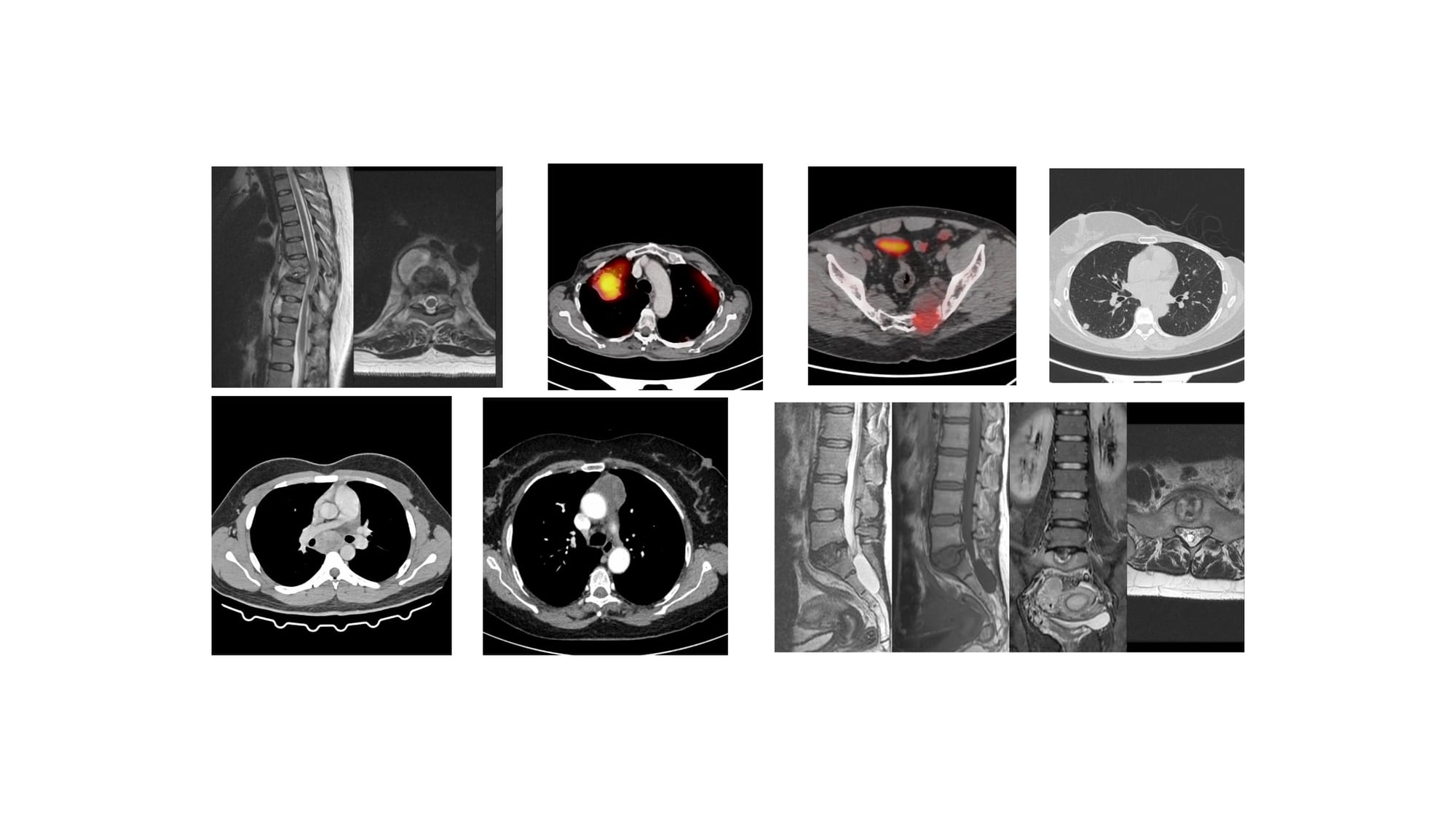The 7 Cases for YouTube Live on 08 Jan at 7 PM Indian Standard Time